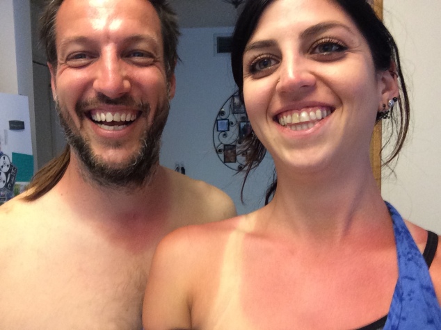 His and Hers Sunburns